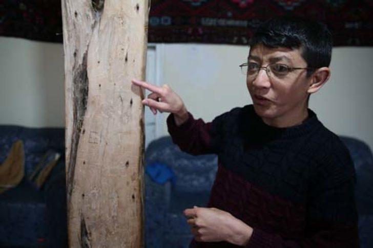 Doğduktan 40 gün sonra gözlerini açabilmişti! Şimdi yaşını duyan kulaklarına inanamıyor G4