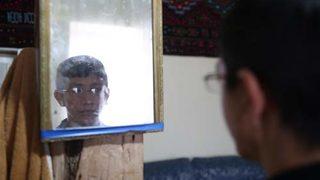 Kayseri'de yaşayan Fatih'in yaşını duyan inanamıyor! 10 yaşındaki çocuk gibi....