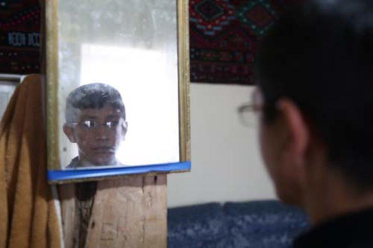 Doğduktan 40 gün sonra gözlerini açabilmişti! Şimdi yaşını duyan kulaklarına inanamıyor G1