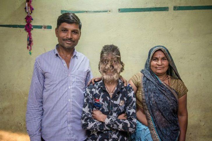 Küçük 'kurtadam'ın ilginç hayatı! G2