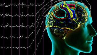 Epilepsi nöbeti geçiren birine nasıl müdahale edilmeli? 