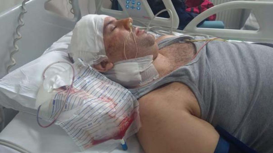 Baş ağrısı şikayetiyle gitti! Hayatı karardı... 