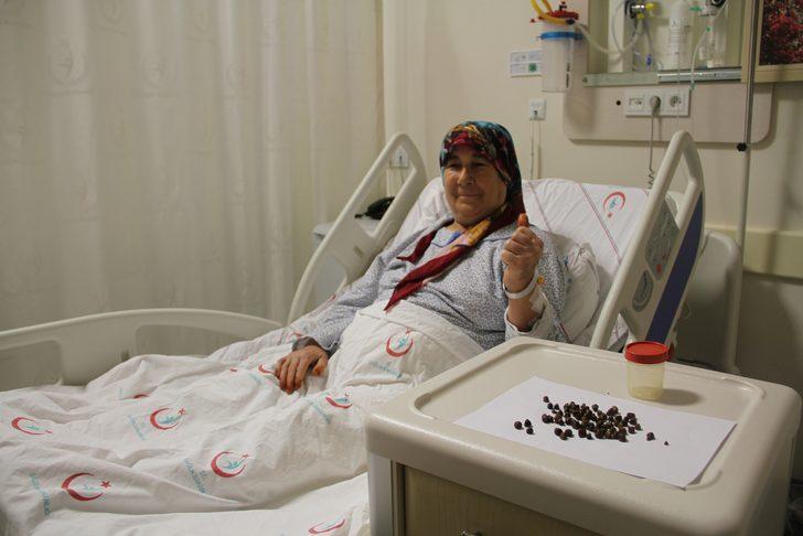 Hepsini ameliyatla çıkardılar! Tam 86 tane G3