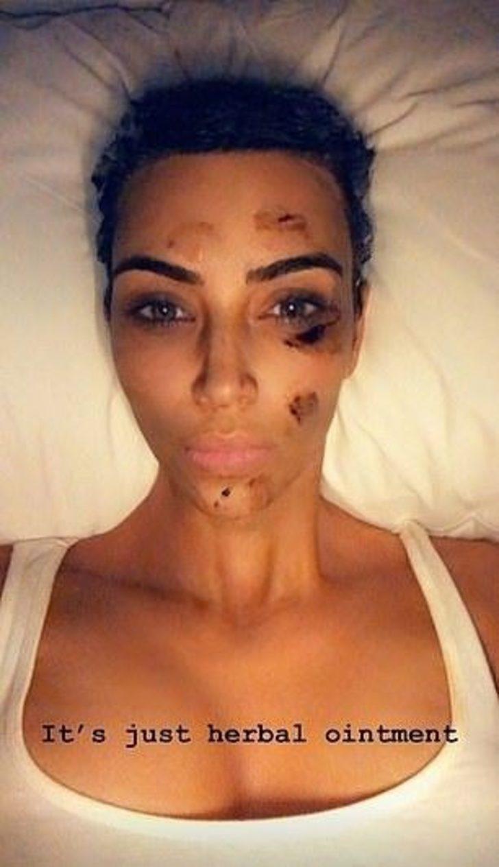 Kim Kardashian'a ne oldu? G3