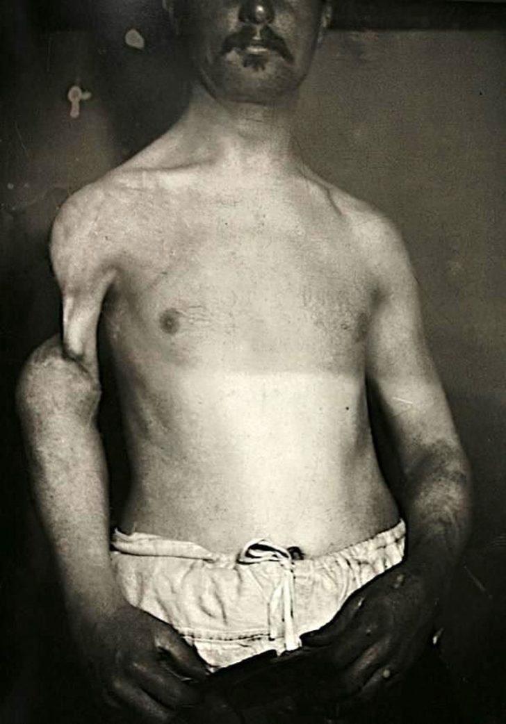 Bu kareler sizi rahatsız edebilir!  G5