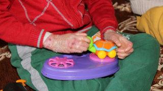 Kelebek hastası kardeşler görenlerin yüreklerini burkuyor! 'Çocuklarımı kuş gibi besliyorum'