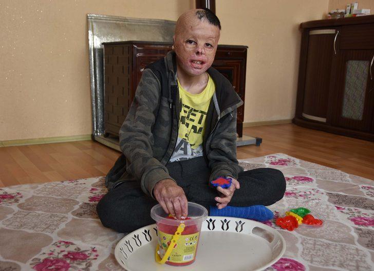 13 yaşındaki Kadir hayatını geri istiyor  G2