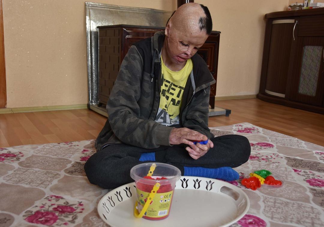 13 yaşındaki Kadir hayatını geri istiyor 