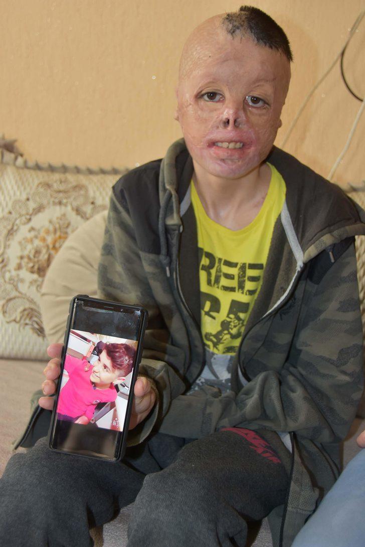 13 yaşındaki Kadir hayatını geri istiyor  G4