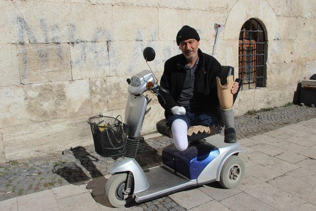 İki ayağı ve bir kolu kesildi yine sigaradan vazgeçmedi 1
