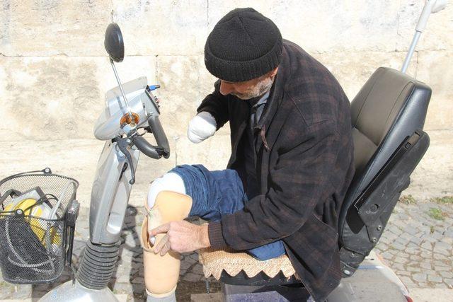 İki ayağı ve bir kolu kesildi yine sigaradan vazgeçmedi 2