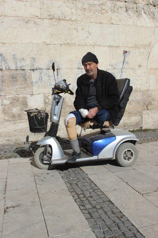 İki ayağı ve bir kolu kesildi yine sigaradan vazgeçmedi 3