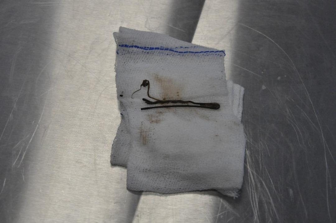 (&Ouml;zel Haber) Kedinin karnından &ccedil;ıkan şaşırttı