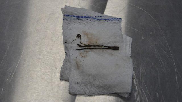 (Özel Haber) Kedinin karnından çıkan şaşırttı