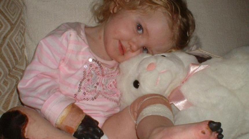 Henüz 15 aylıkken ellerini kaybetmişti! Şimdi makyaj bile yapıyor