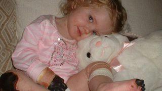 Henüz 15 aylıkken ellerini kaybetmişti! Şimdi makyaj bile yapıyor