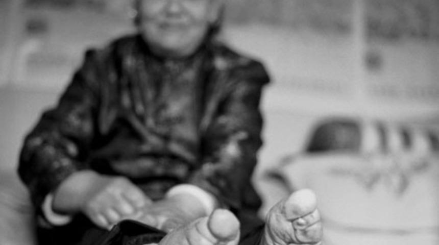 G&uuml;zellik uğruna &ccedil;ekilen eziyet