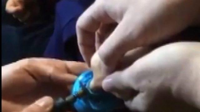 Öğrencinin parmağını sıkıştırdığı su termosu kapağı kesilerek çıkartıldı