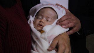 Yağmur bebek tıp literatürüne girebilir! Doktorlar 'ilk kez karşılaştık' dedi