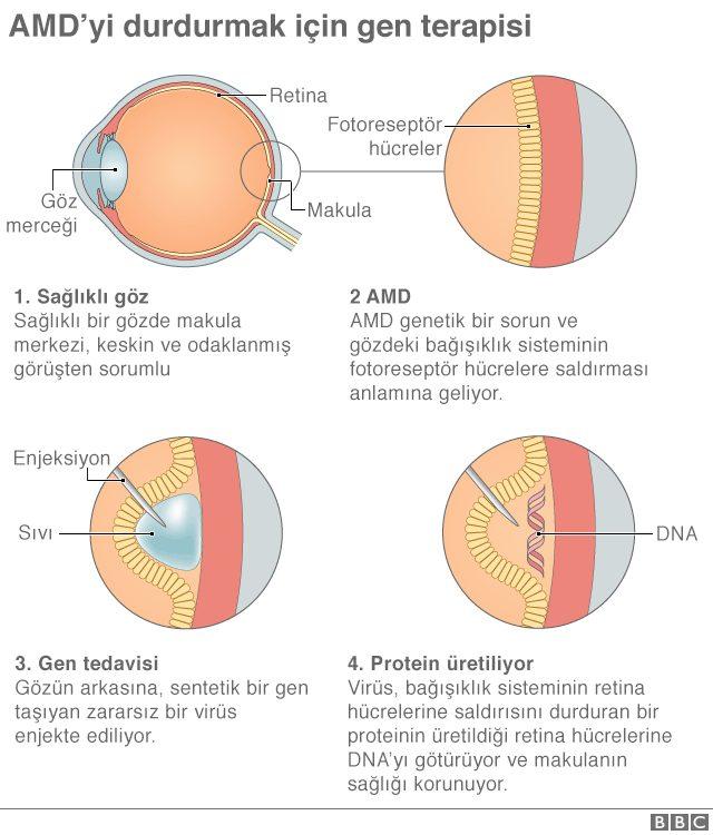 grafik