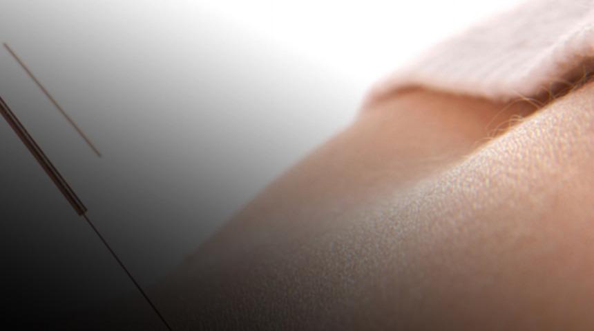  K&uuml;&ccedil;&uuml;k bir iğne deyip ge&ccedil;meyin! Akupunktur tedavisi menopozun etkilerini azaltıyor