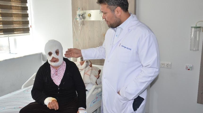 Elbistan Devlet Hastanesi Yanık Odası, 443 hastaya hizmet verdi