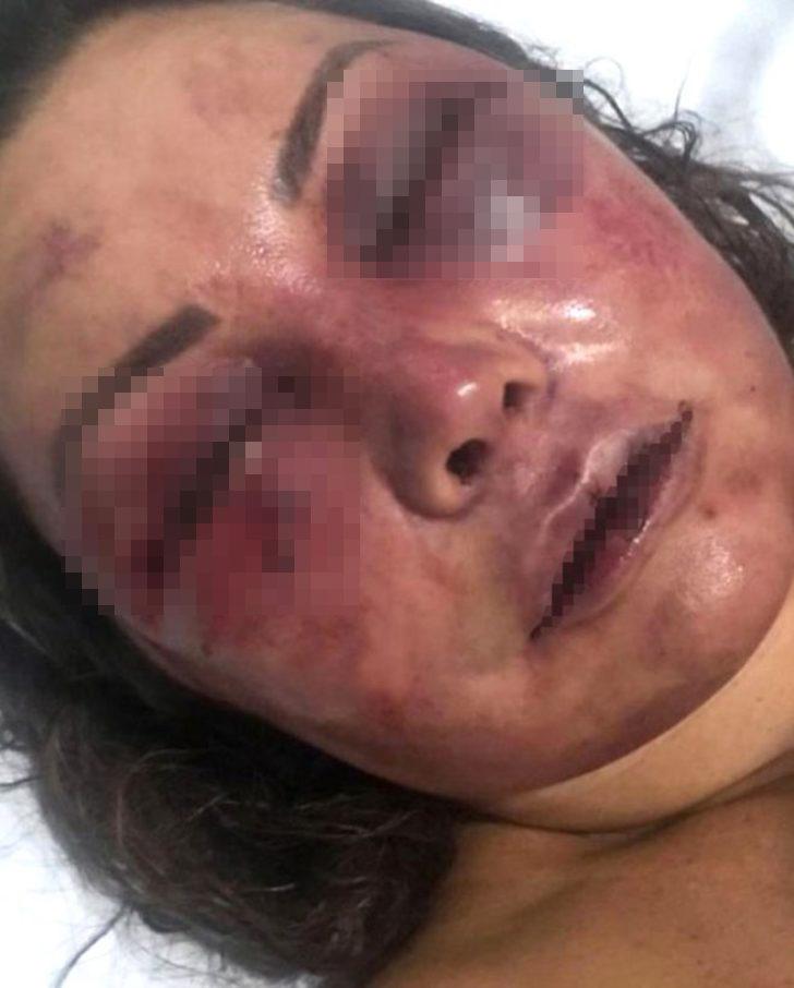 İnternetten tanıştığı adam dehşeti yaşattı! O halde gören yüzüne bakamadı G3