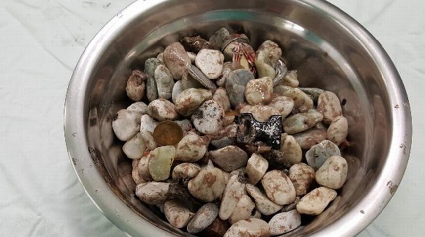 İnanılmaz! Midesinden &ccedil;ıkan şoke etti