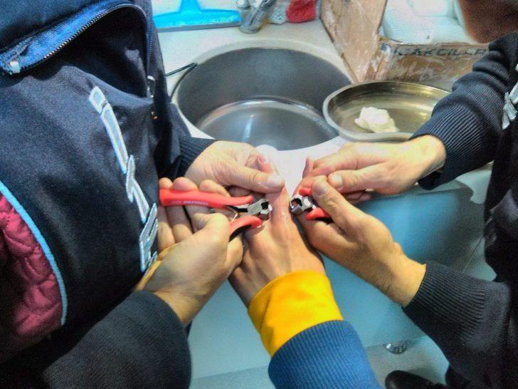 Parmağa sıkışan yüzük kesilerek çıkarıldı G1