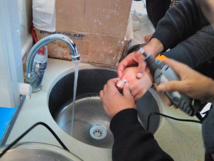 Parmağa sıkışan yüzük kesilerek çıkarıldı G3