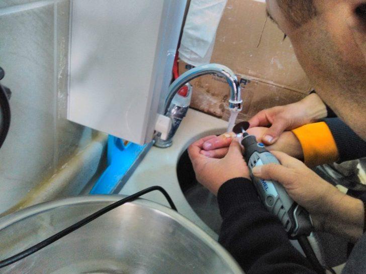 Parmağa sıkışan yüzük kesilerek çıkarıldı G4