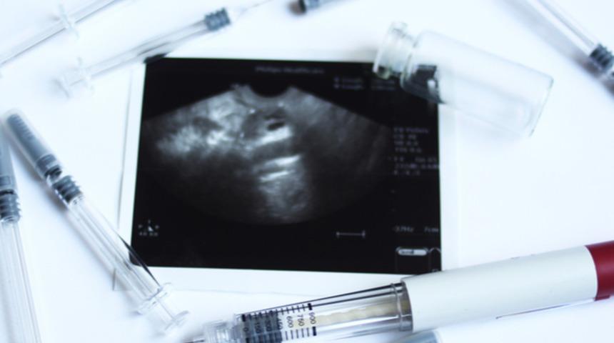 HSG (İlaçlı Rahim Filmi) nedir, hangi durumlarda istenir?