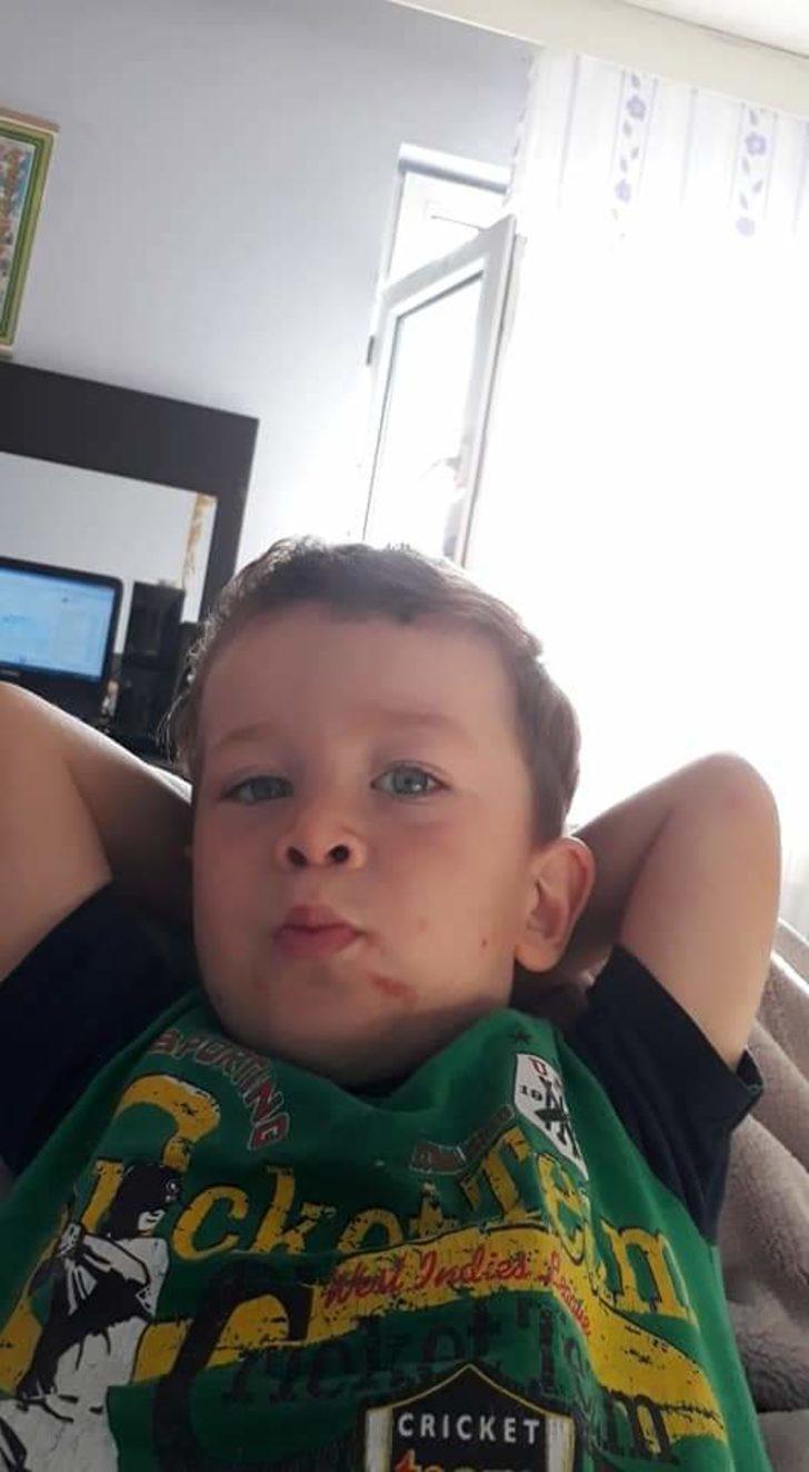 Bademcik ameliyatından 1 gün sonra öldü G3