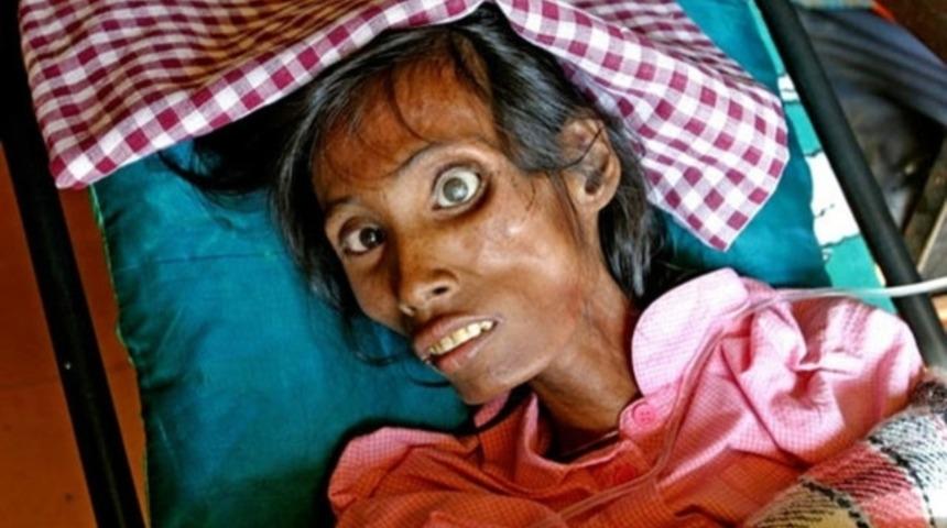 İşte en ölümcül 10 hastalık!