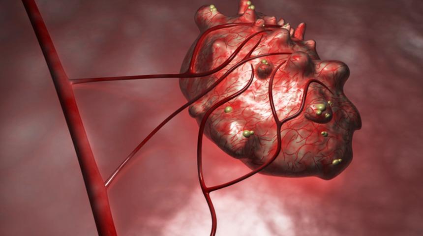 Sinsice ilerliyor! Yumurtalık kistleri ne anlama geliyor, doktora ne zaman gitmeli?