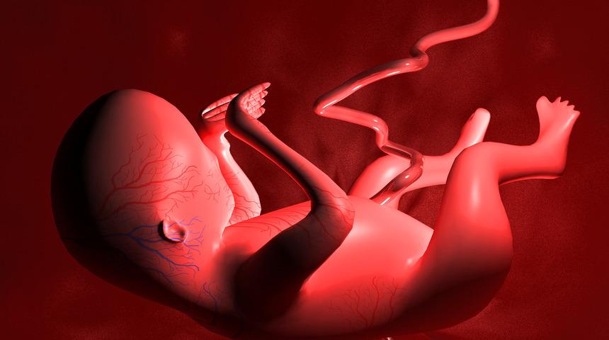 Amniyotik Bant (Amniotic Band) Sendromu nedir, tedavisi var mı?