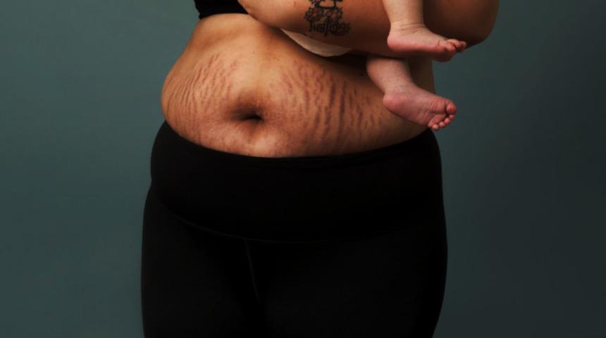 Anneliğin gerçek yolculuğu! Sosyal medyadaki fotoğrafları unutun 