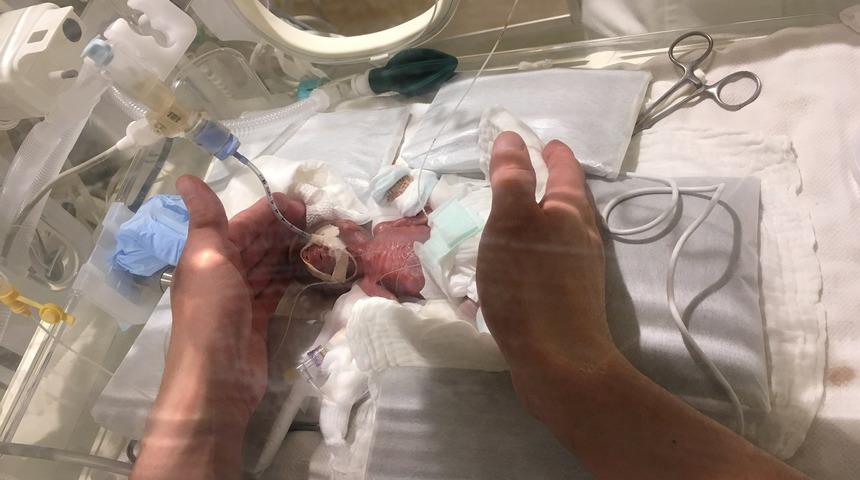 Bir paket margarin kadar! D&uuml;nyanın en k&uuml;&ccedil;&uuml;k bebeği 268 gram ağırlığında 