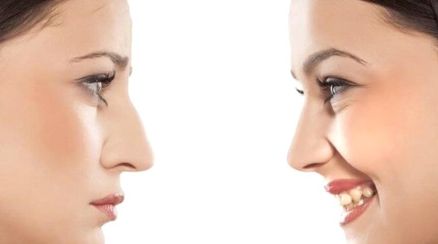 Revizyon burun ameliyatı sizi korkutmasın!