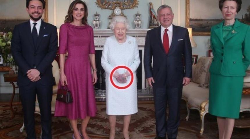 Kraliçe Elizabeth’in elindeki morluk endişelendirdi