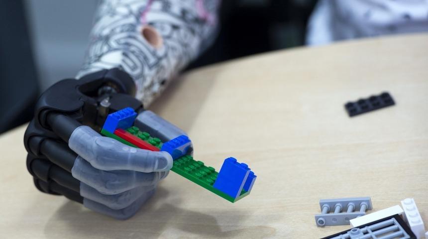 Biyonik protezler tehlike altında