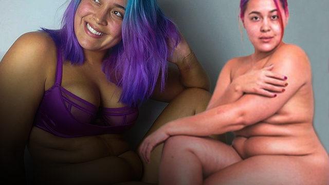 Ölmek üzereyken bile zayıflamayı düşünüyordu, şimdi milyonlarca kişiye ilham oluyor