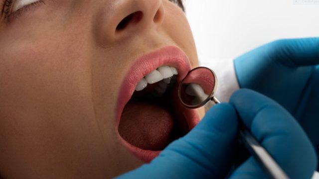 İmplant nedir, porselen köprü tedavisi nedir, nasıl yapılır? İmplant acılı ve ağrılı bir işlem midir? 