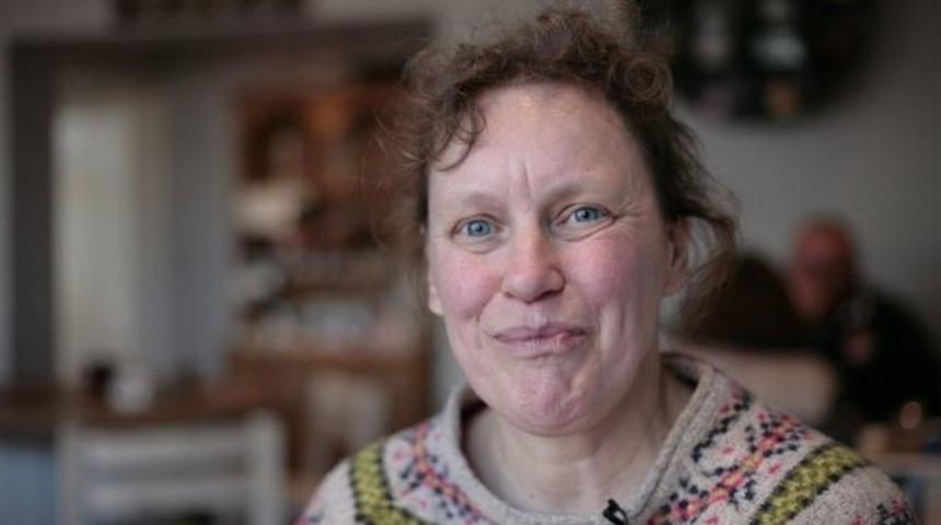 Y&uuml;z k&ouml;rl&uuml;ğ&uuml;: Herkesi g&ouml;r&uuml;yor, kimseyi tanıyamıyor