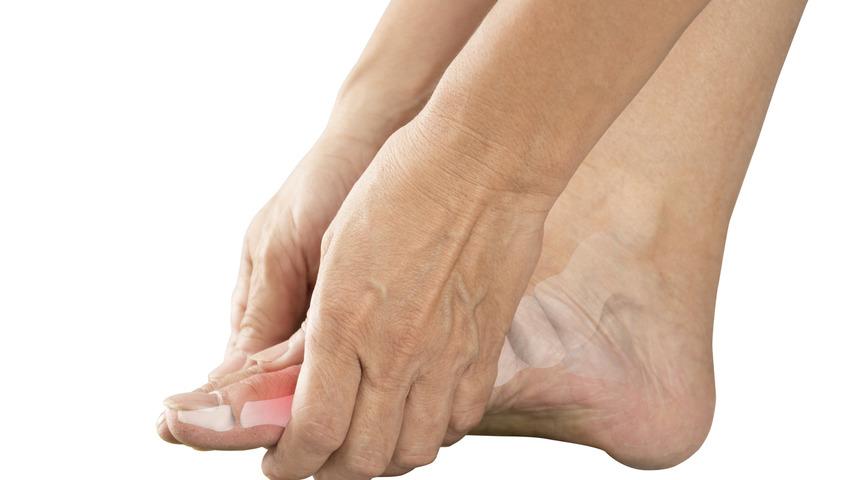 Gut hastalığı nedir? Gut hastalığında beslenme ve immünoterapinin önemi nedir?