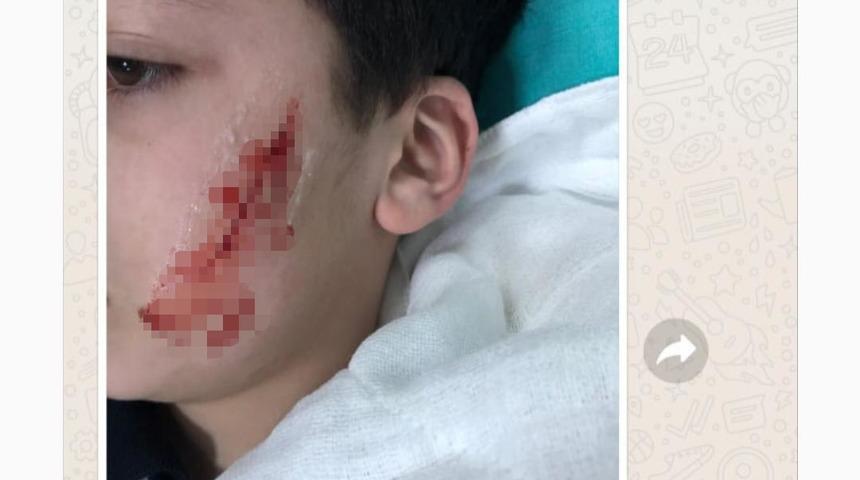 Sınıfta şakalaştığı arkadaşını kalemtıraş bıçağı ile yaraladı