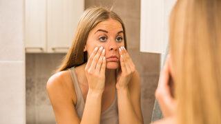 Glokom nedir, belirtileri nelerdir? Glokomun tedavisi var mıdır? 