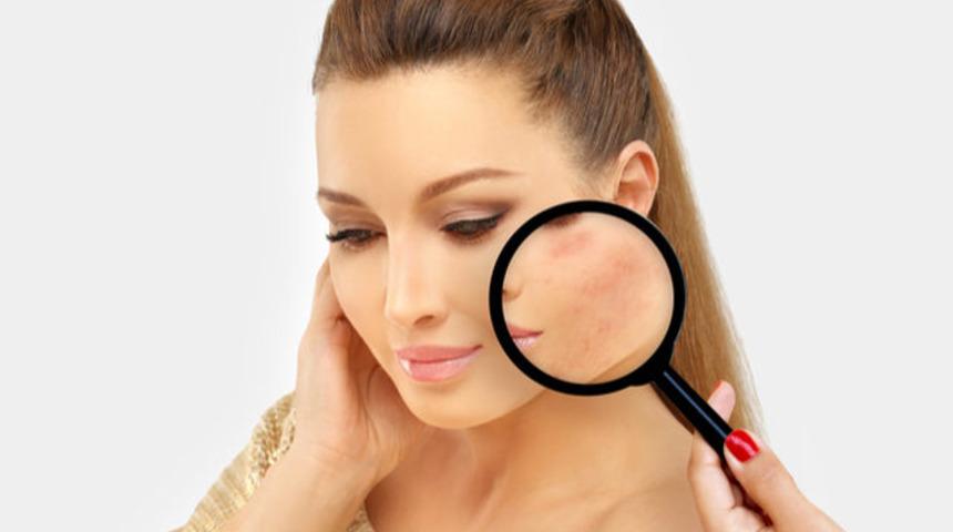 Dikiş izleri hangi uygulamalarla düzeltilebilir?