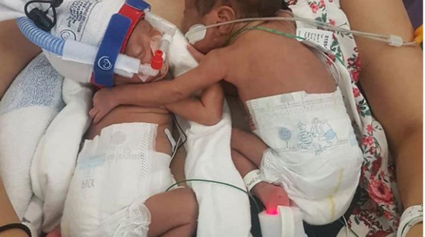 Yoğun bakımdan dönen ikizini 'kucaklayan' bebeğin o anları görülmeye değer