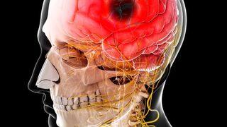 Dünya orgazm olmak üzereyken felç olan kadını konuşuyor!